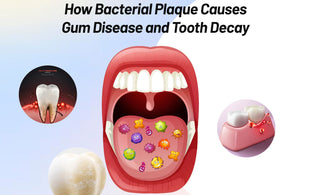 How Dental Bacterial Plaque Causes Gum Disease and How to Prevent It