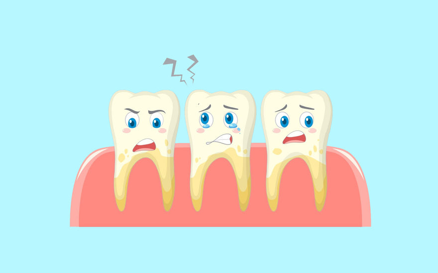 Black Tartar on Teeth: Causes and How to Get lt Removed