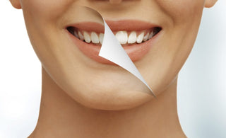 How Long Does Teeth Whitening Last?