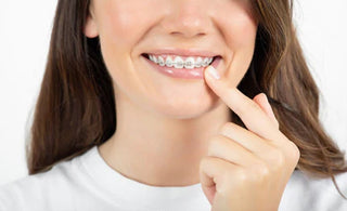 Essential Dental Care Tips for Braces Wearers: Maintaining a Healthy Smile