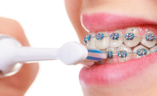 Can You Use an Electric Toothbrush on Braces?